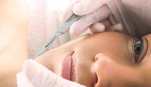The Benefits Of A Dermaplaning Facial And How Should It Be Done