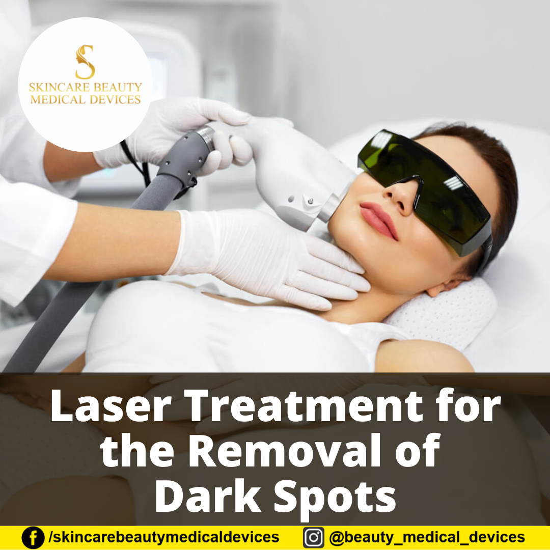 Laser Treatment for the Removal of Dark Spots