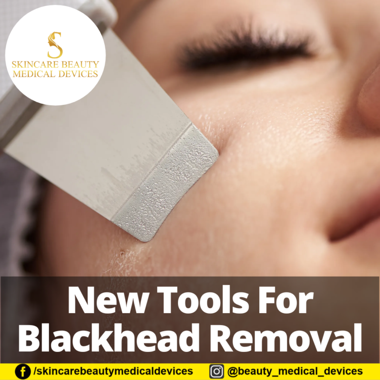 New Tools For Blackhead Removal