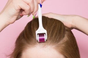 Derma Roller for Hair Growth: Here’s What You Need to Know