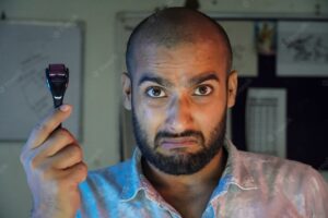 Derma Roller for Hair Growth: Here’s What You Need to Know