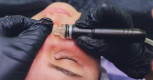 Risks And Benefits Of A Pore Vacuum