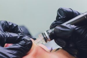 Risks And Benefits Of A Pore Vacuum