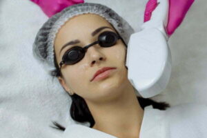 Professional Procedures To Get Rid Of Brown Spots On The Skin