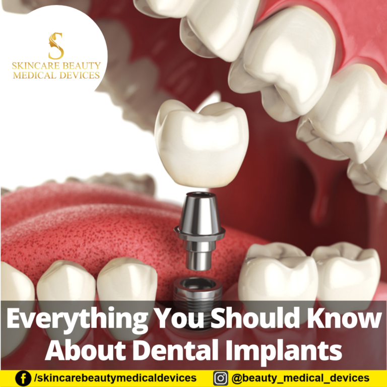 Everything You Should Know About Dental Implants
