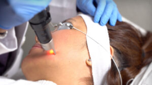 Professional Procedures To Get Rid Of Brown Spots On The Skin