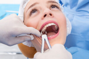 Abscessed Tooth And Its Treatment