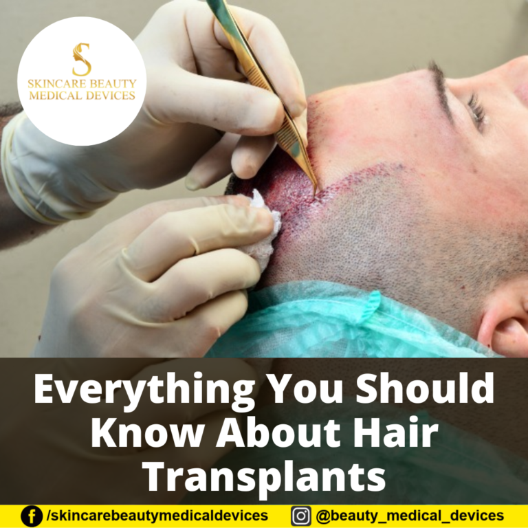 Everything You Should Know About Hair Transplants