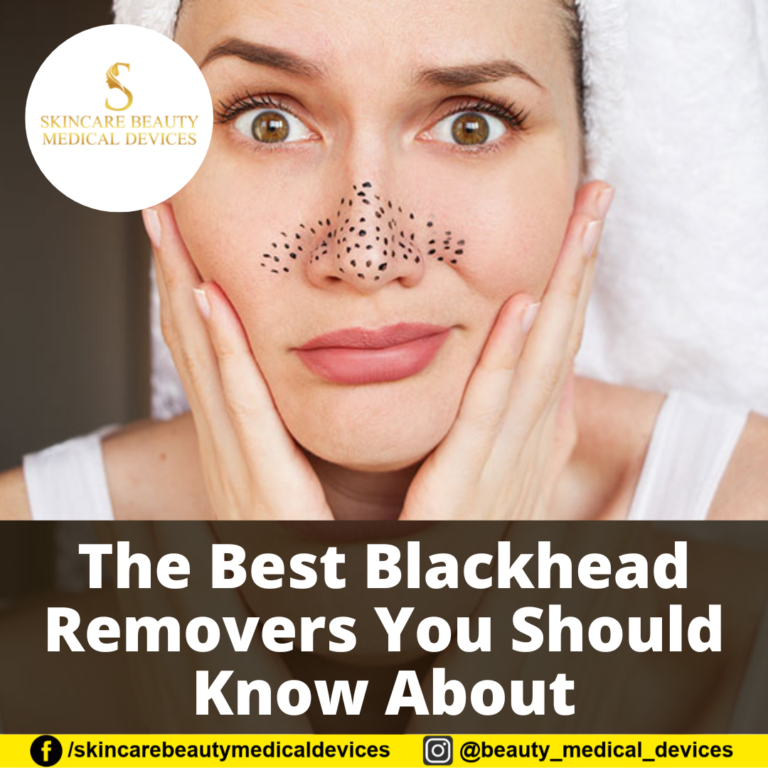 The Best Blackhead Removers You Should Know About