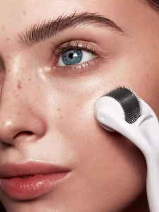 Microneedling