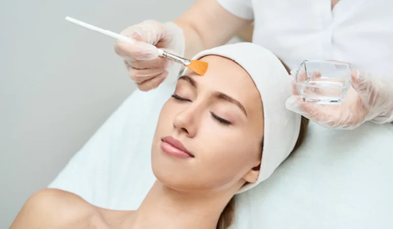 Everything You Need To Know About Chemical Peels