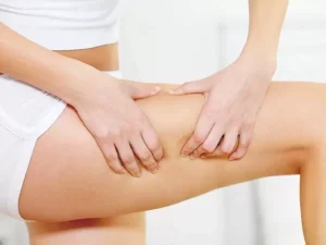 Cellfina: The Cellulite Treatment You Need To Know About