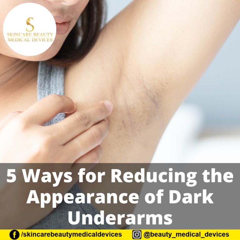 5 Ways for Reducing the Appearance of Dark Underarms