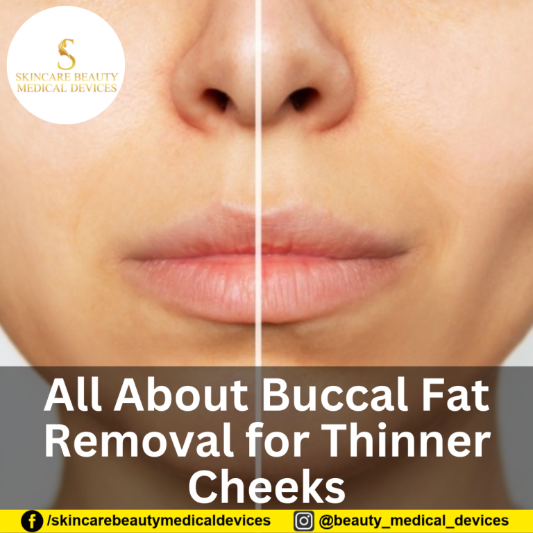 All About Buccal Fat Removal for Thinner Cheeks