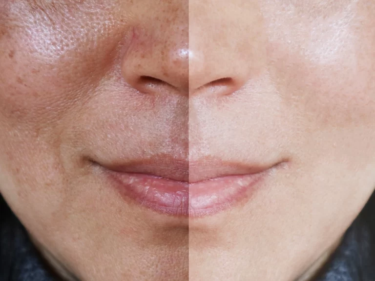 Say Goodbye to Makeup with BB Glow