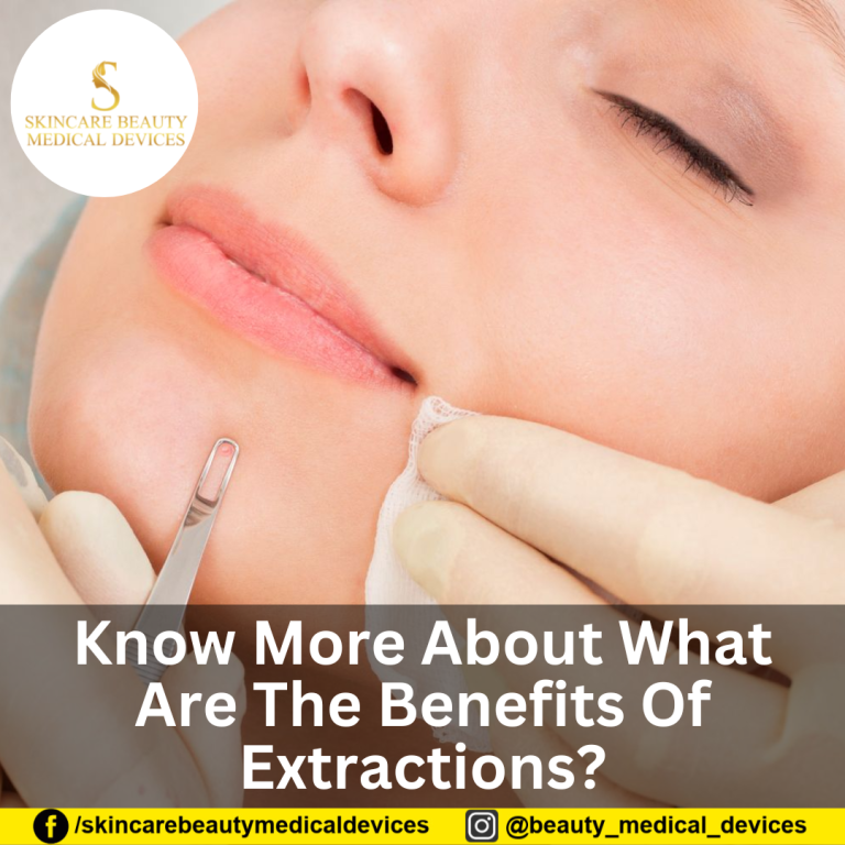 Know More About What Are The Benefits Of Extractions?