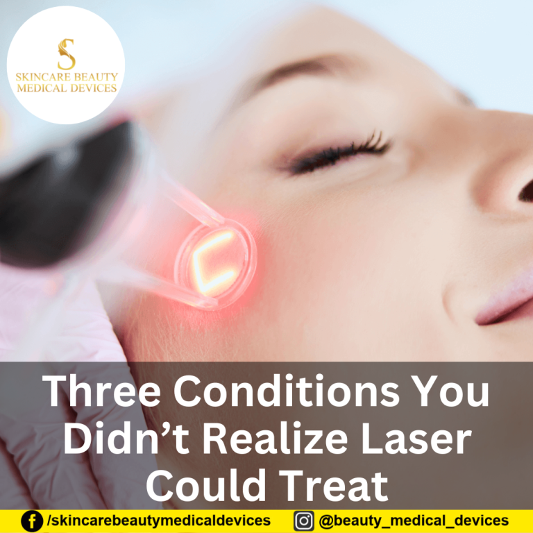 Three Conditions You Didn’t Realize Laser Could Treat