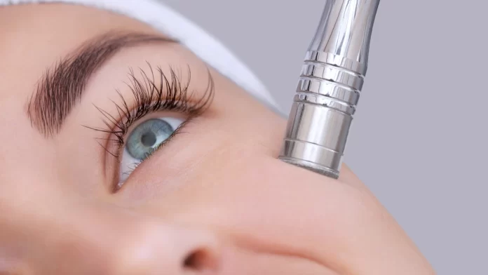 Is At-home Microdermabrasion Worth the Investment?