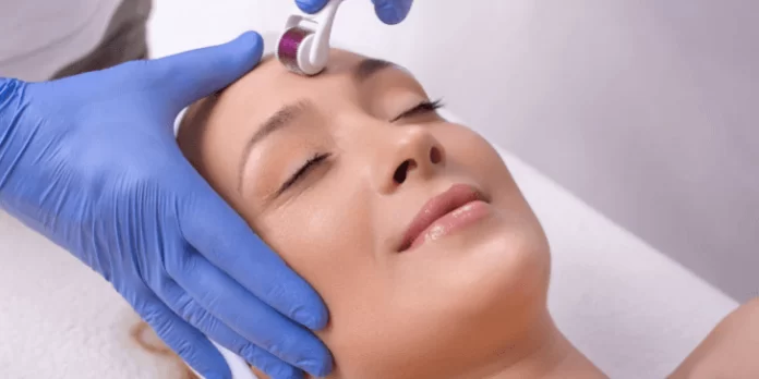 Collagen Induction Therapy: The Latest Advancement in Skincare
