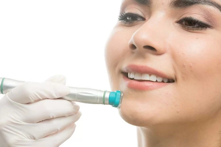 Revolutionize Your Skincare Routine with MIRApeel