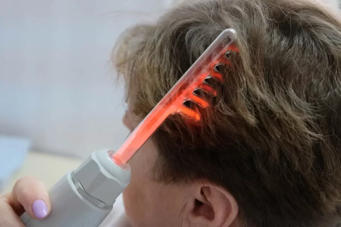 Electrifying Results: High Frequency Therapy for Hair Loss