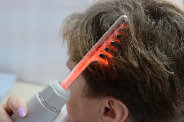 Electrifying Results: High Frequency Therapy for Hair Loss