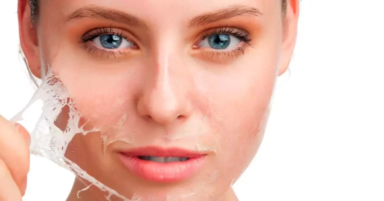 Chemical Peel Treatment: What You Need to Know