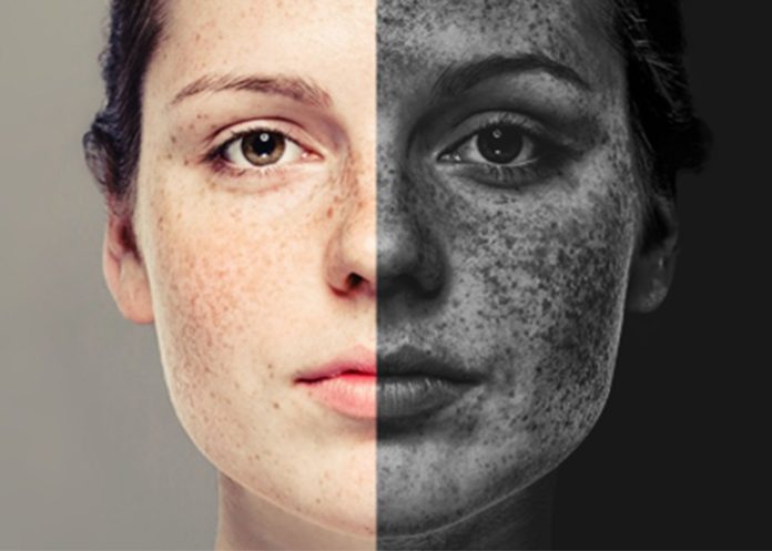 Protecting Your Skin from Pollution: Tips and Tricks to Keep it Healthy and Glowing
