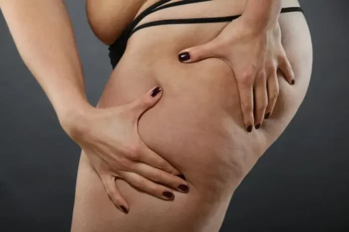 The Pros and Cons of Liposuction: What You Need to Know