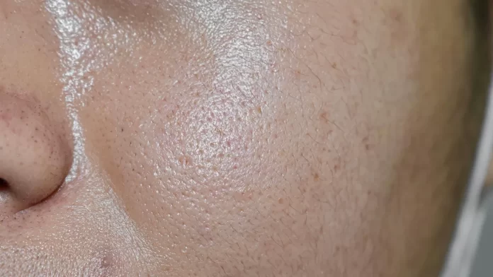 Say Goodbye to Oily Skin: 10 Must-Do Skincare Habits