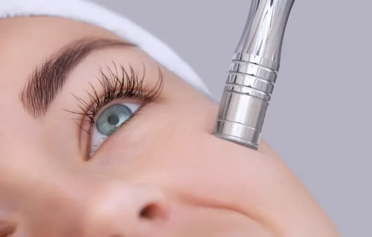 Say Goodbye to Dull Skin: The Benefits of Microdermabrasion
