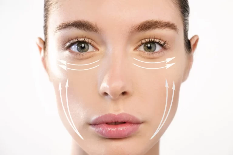 Revitalize Your Skin with Thread Lifts: Benefits and Results