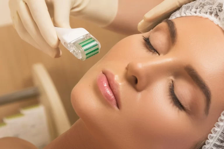 Microneedling: The Good, the Bad, and the Ugly