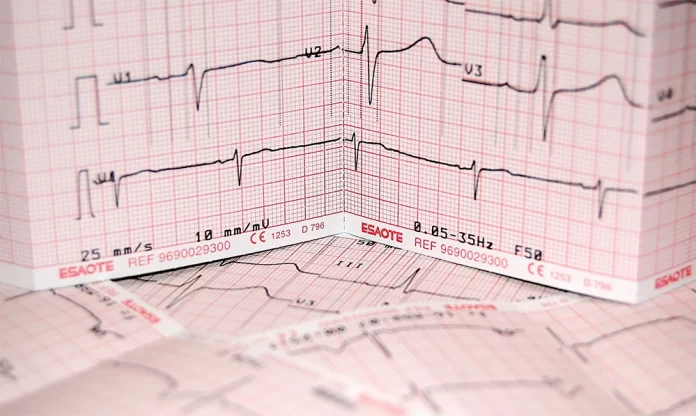 ECG Interpretation Made Easy: The App That Will Help You Ace It