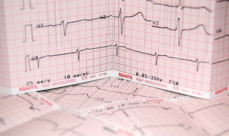 ECG Interpretation Made Easy: The App That Will Help You Ace It