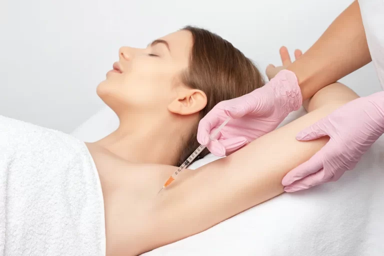 Sweat No More: How Botox Treatment Prevents Excessive Sweating