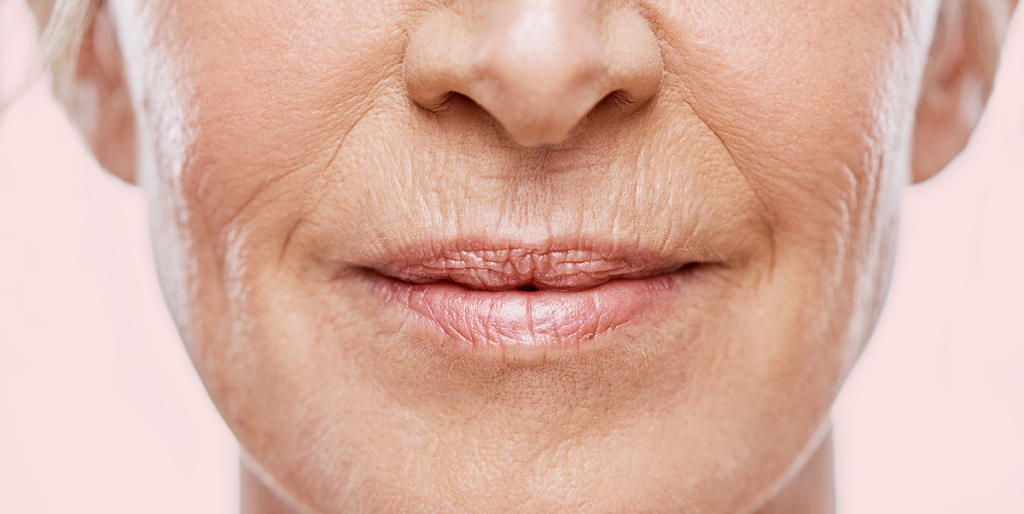 Smooth and Youthful Effective Ways to Combat Wrinkles Above Lips