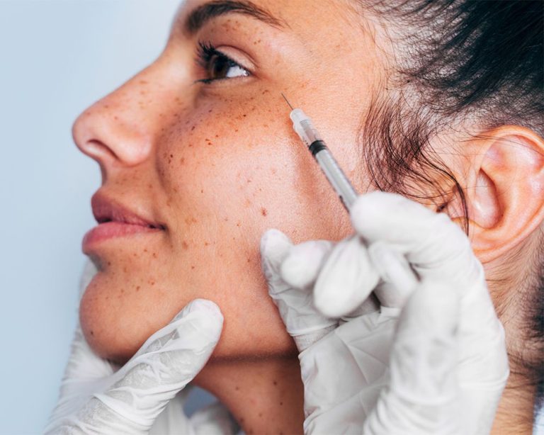 Botox for Wrinkles: Rediscover Youthful Skin with a Simple Treatment