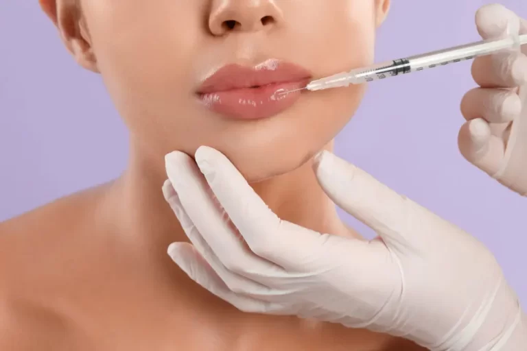 Unlocking the Beauty of Big Lips with Fillers: Enhancing Natural Beauty Safely and Confidently