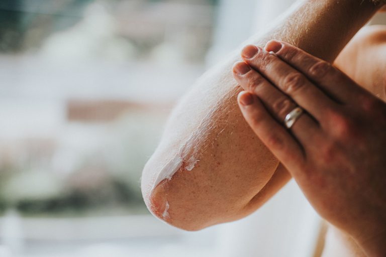 Nurturing Radiance: Understanding and Treating Dry Skin