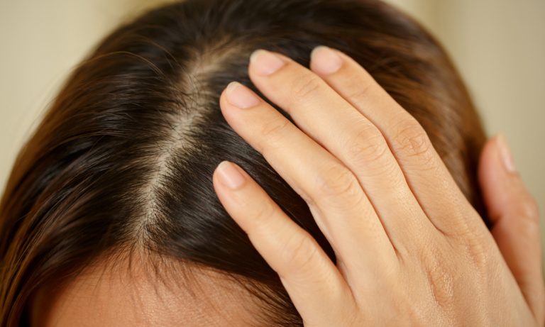 The Itch You Can’t Ignore: Understanding and Tackling Scalp Itch