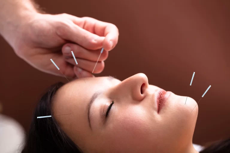 Harnessing the Power of Beauty Acupuncture: A Dermatologist’s Perspective