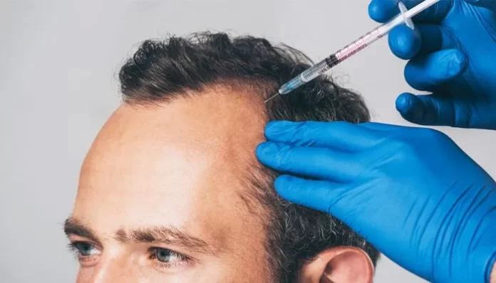 Mane Matters: Dermatologist-Recommended Treatments for Hair Loss
