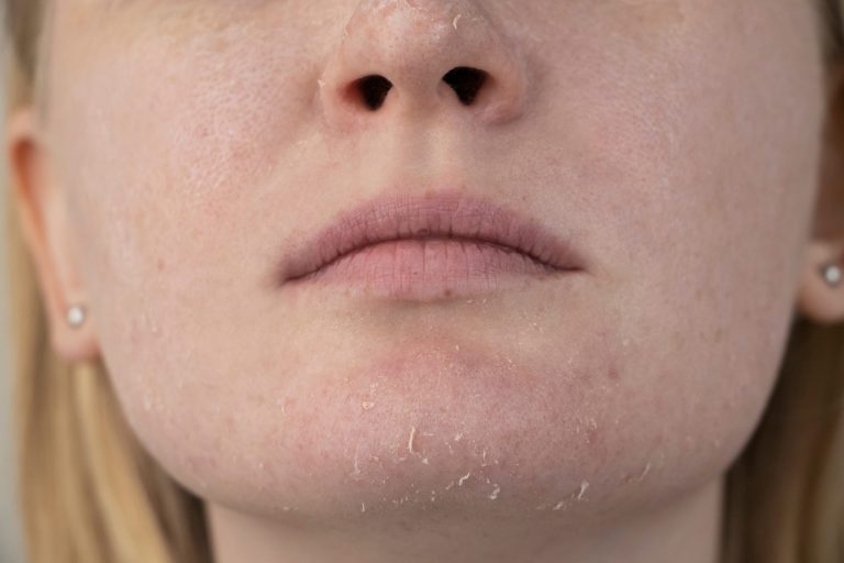 Understanding Skin Dehydration and the Rise of At-Home Measurement Devices