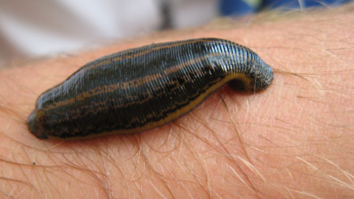 Exploring Leech Therapy: A Traditional Approach to Pain Management