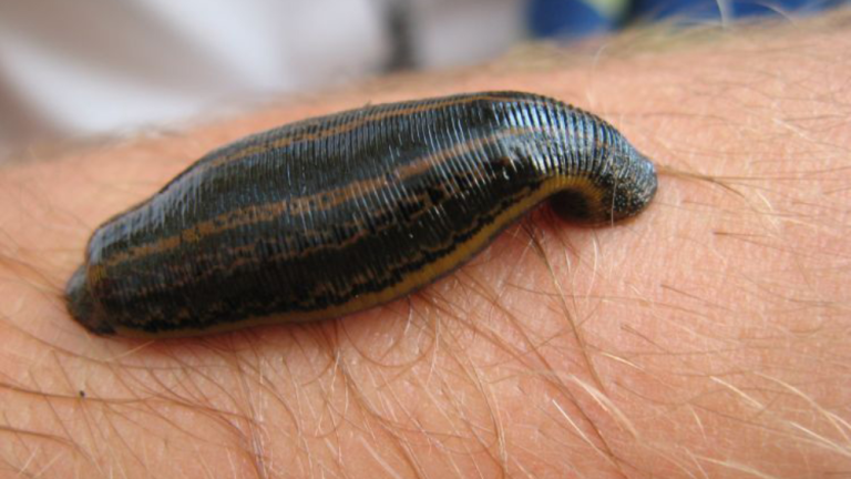 Exploring Leech Therapy: A Traditional Approach to Pain Management