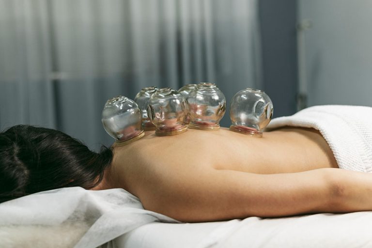 Exploring the Ancient Healing Art of Cupping Therapy