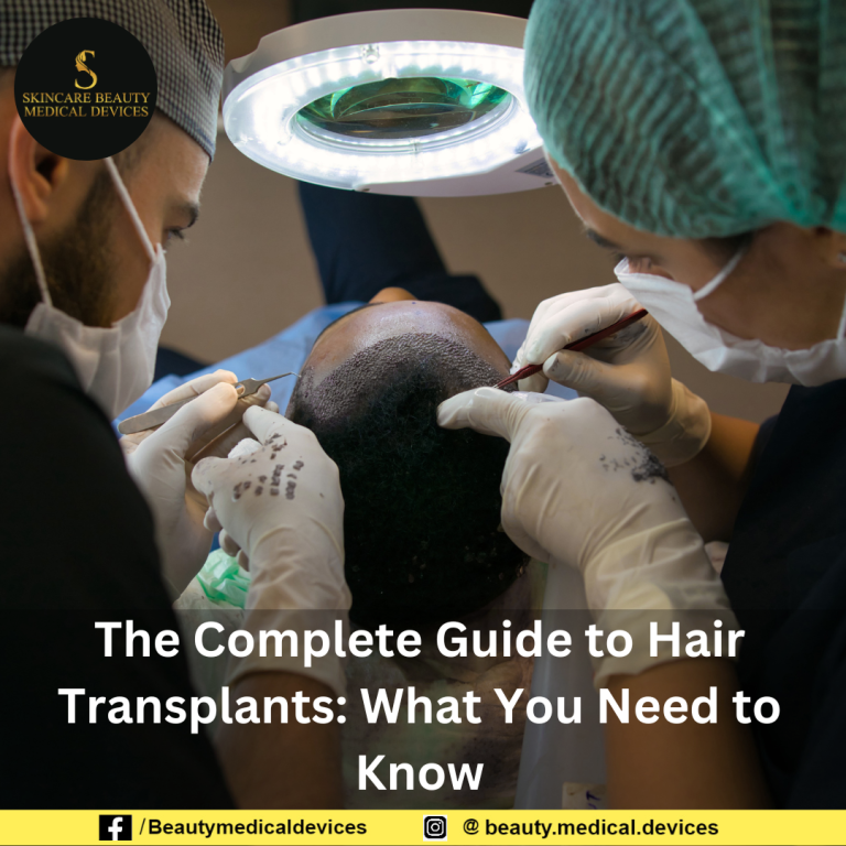The Complete Guide to Hair Transplants: What You Need to Know
