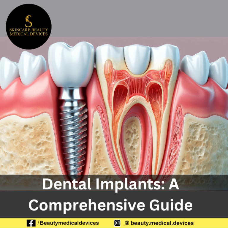 Dental Implants: A Comprehensive Guide
