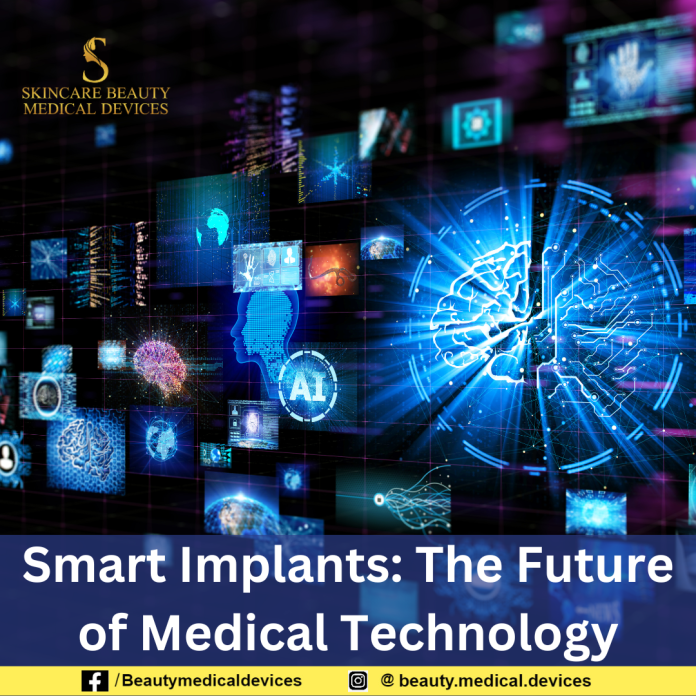 Smart Implants: The Future of Medical Technology